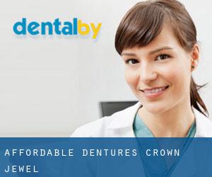 Affordable Dentures (Crown Jewel)