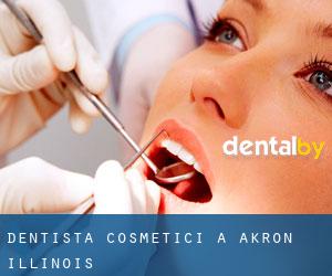 Dentista cosmetici a Akron (Illinois)