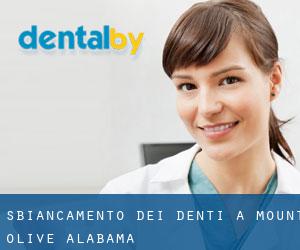 Sbiancamento dei denti a Mount Olive (Alabama)