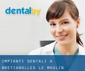 Impianti dentali a Brétignolles-le-Moulin