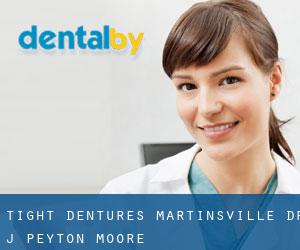 Tight Dentures Martinsville Dr. J Peyton Moore